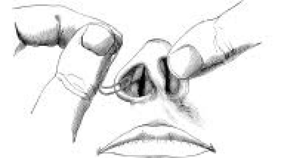 nose surgery