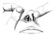 nose surgery